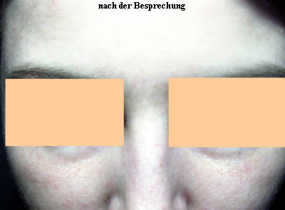 warzenfrei-vornenah warzenfrei-vornenah